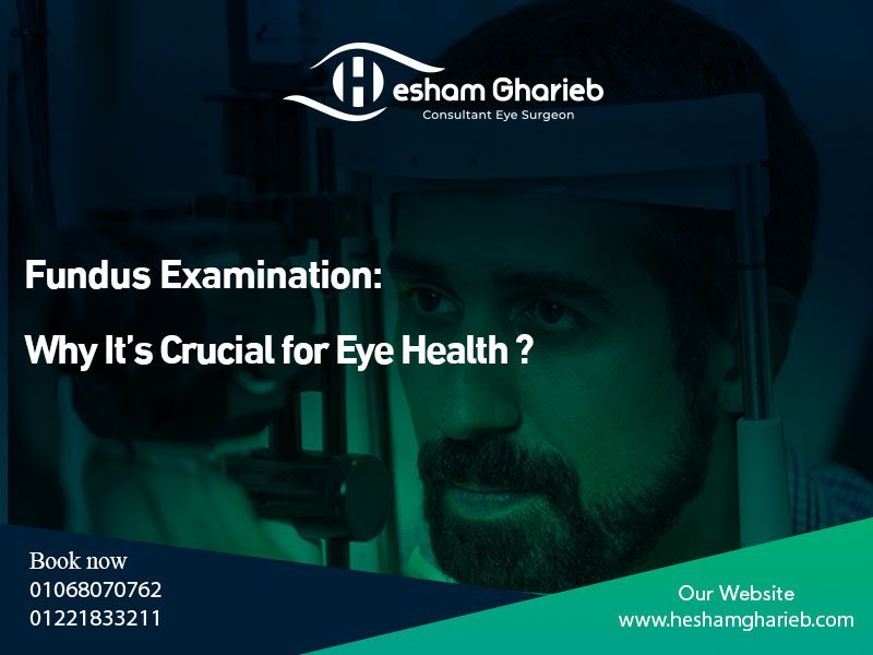 Fundus Examination in Egypt : Why It’s Crucial for Eye Health
