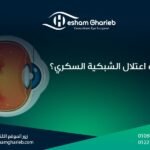 ما هو اعتلال الشبكية السكري؟ | علاج تلف الشبكية بسبب السكر في مصر