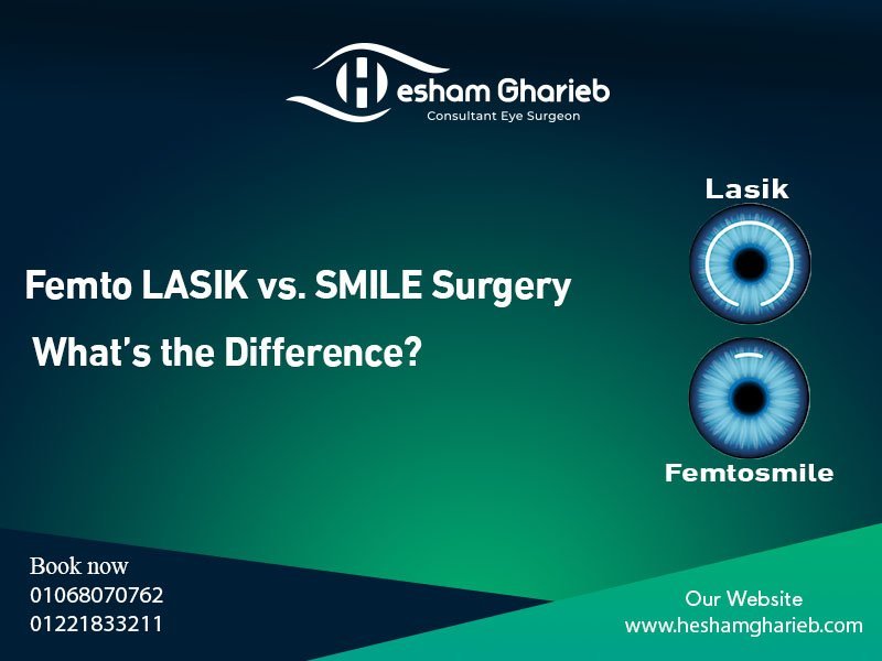 Femto LASIK vs. SMILE Surgery in Egypt: Key Differences, Benefits & Best Choice for You