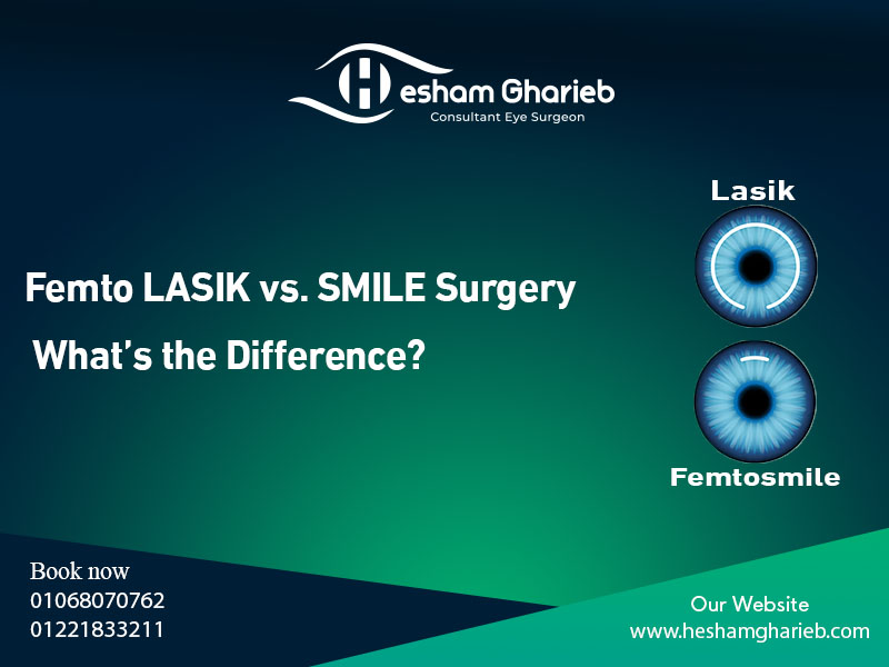 Femto LASIK vs. SMILE Surgery in Egypt: Key Differences, Benefits & Best Choice for You Keratoconus