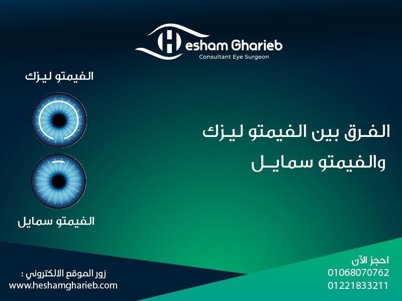 الفرق بين الفيمتو ليزك والفيمتو سمايل: دليلك لاختيار التقنية الأنسب لتصحيح الإبصار