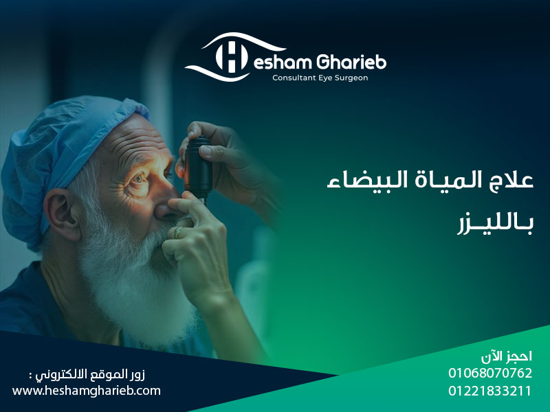 علاج المياه البيضاء بالليزر: استعادة الرؤية باستخدام أحدث تقنيات الطب عملية تصحيح النظر