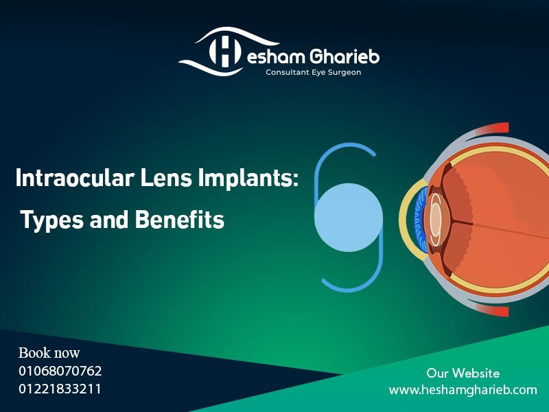 Intraocular Lens Implants: Types, Benefits, and What You Need to Know for Vision Correction in Egypt