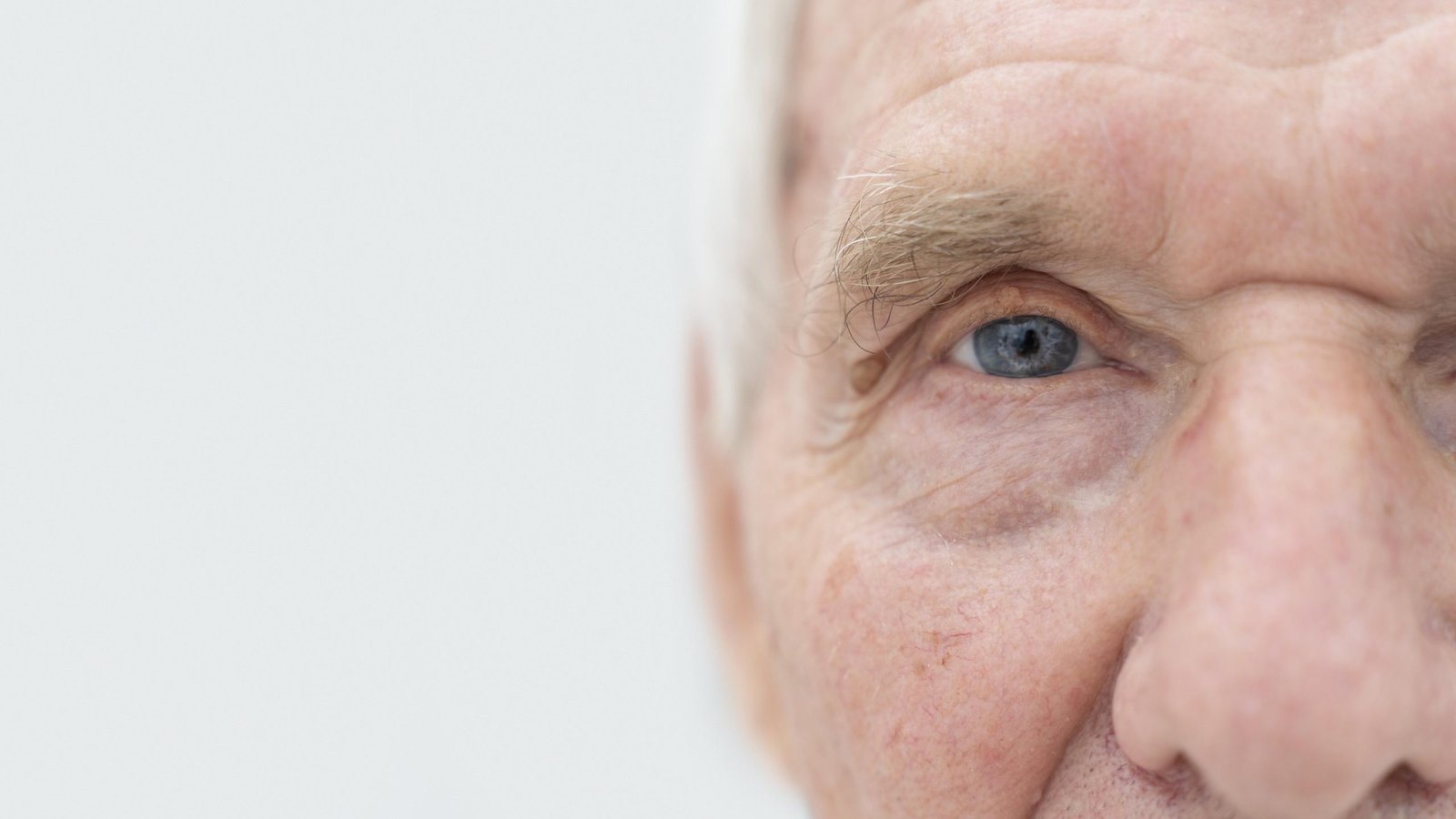 Laser Cataract Surgery