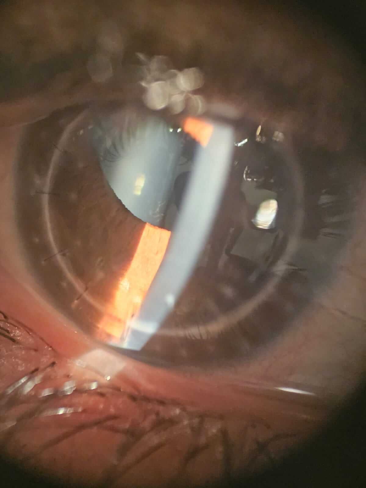 Before image