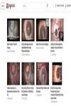 EyeTube-2
